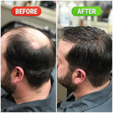 Rosemary & Rice Water Hair Growth Spray - 200ml