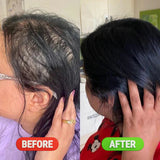 Rosemary & Rice Water Hair Growth Spray - 200ml